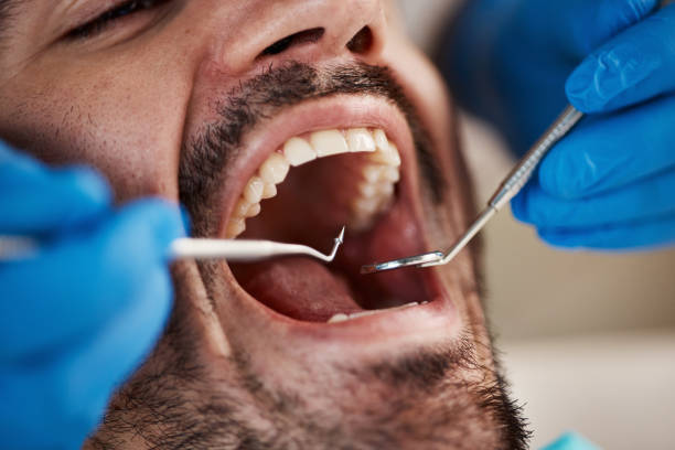 Best Emergency Treatment for Dental Infections or Abscesses in Fitchburg, WI