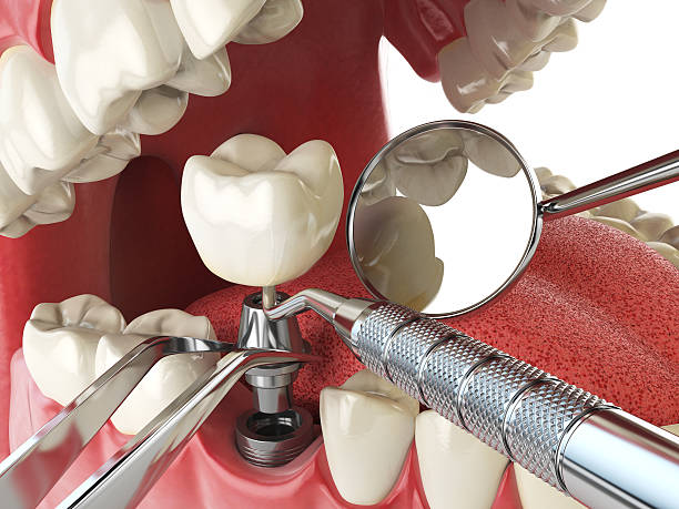 Best Weekend Emergency Dentist in Fitchburg, WI
